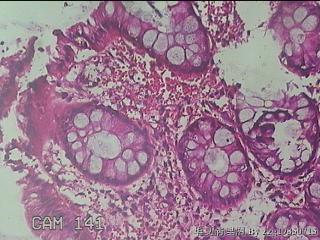 直肠粘膜图35