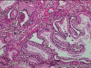 直肠粘膜图3