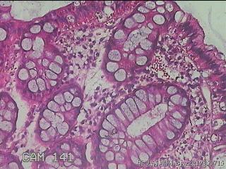 直肠粘膜图16