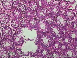 直肠粘膜图8