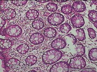 直肠粘膜图15
