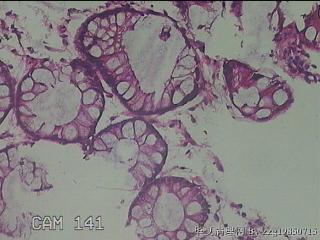 直肠粘膜图18