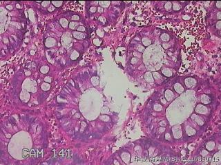 直肠粘膜图25