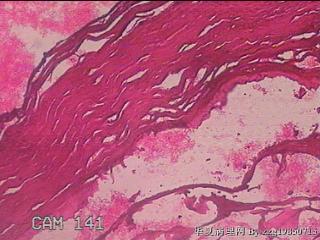 肠系膜赘生物图40