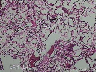 肠系膜赘生物图11