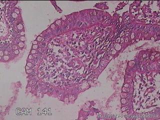 回肠末端粘膜图32