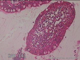 回肠末端粘膜图7