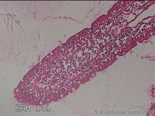 回肠末端粘膜图15