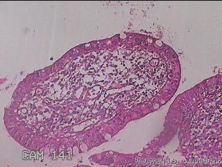 回肠末端粘膜图34
