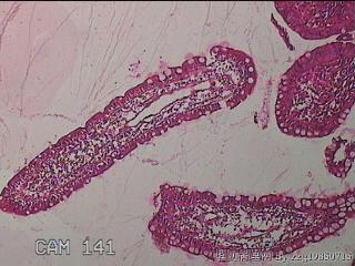 回肠末端粘膜图1