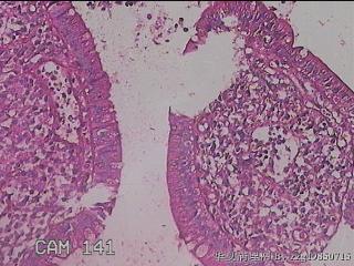 回肠末端粘膜图27