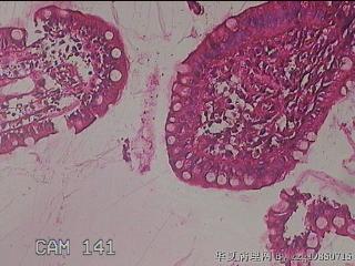 回肠末端粘膜图14