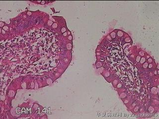 回肠末端粘膜图12