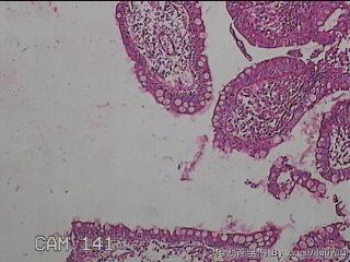 回肠末端粘膜图22