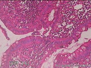 回肠末端粘膜图10