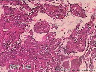胃窦粘膜图1