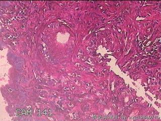 胃窦粘膜图2