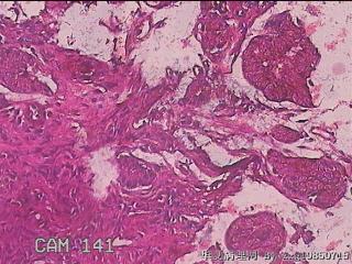 胃窦粘膜图12