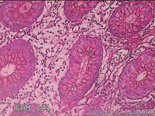 胃窦粘膜图6