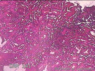 胃窦粘膜图18
