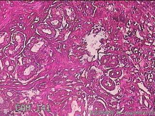 胃窦粘膜图14
