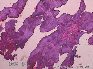 直肠粘膜图24