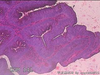 直肠粘膜图43