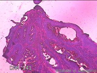 直肠粘膜图13