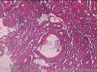 胃窦粘膜图15