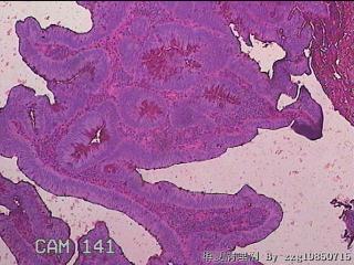 直肠粘膜图29