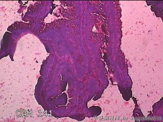 直肠粘膜图17