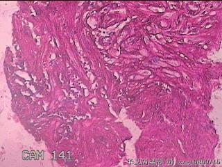 胃角粘膜图17