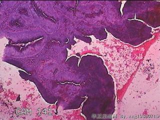 直肠粘膜图10