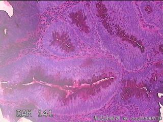 直肠粘膜图38