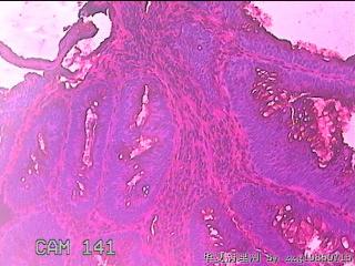 直肠粘膜图42