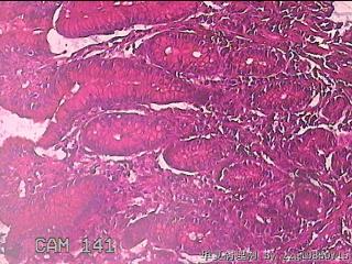 胃窦粘膜图21