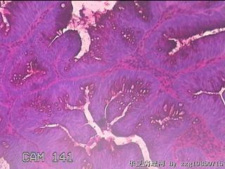 直肠粘膜图44