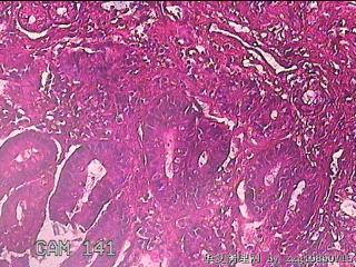 胃窦粘膜图16