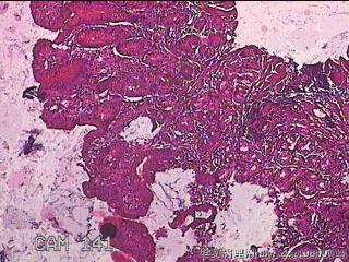 胃窦粘膜图7