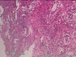 胃窦后壁粘膜图21