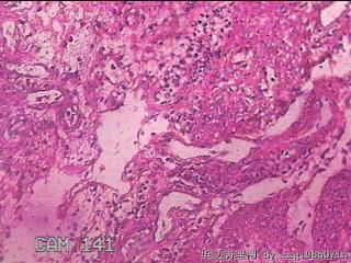 胃窦后壁粘膜图37