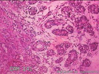 胃窦后壁粘膜图29