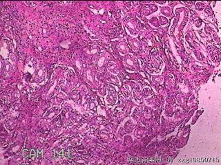 胃窦前壁粘膜图22