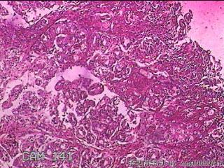胃窦前壁粘膜图10