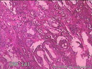 胃窦前壁粘膜图34