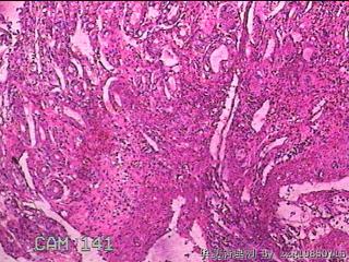 胃窦前壁粘膜图18