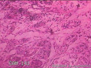 胃窦后壁粘膜图31