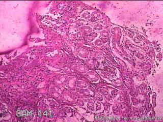 胃窦前壁粘膜图8