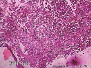 胃窦前壁粘膜图9