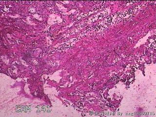 胃窦前壁粘膜图1